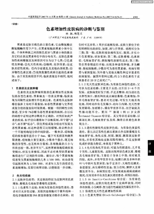 色素增加性皮肤病的诊断与鉴别