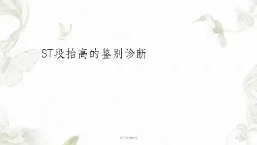 ST段抬高鉴别诊断课件