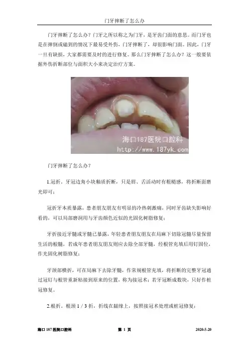 门牙摔断了怎么办