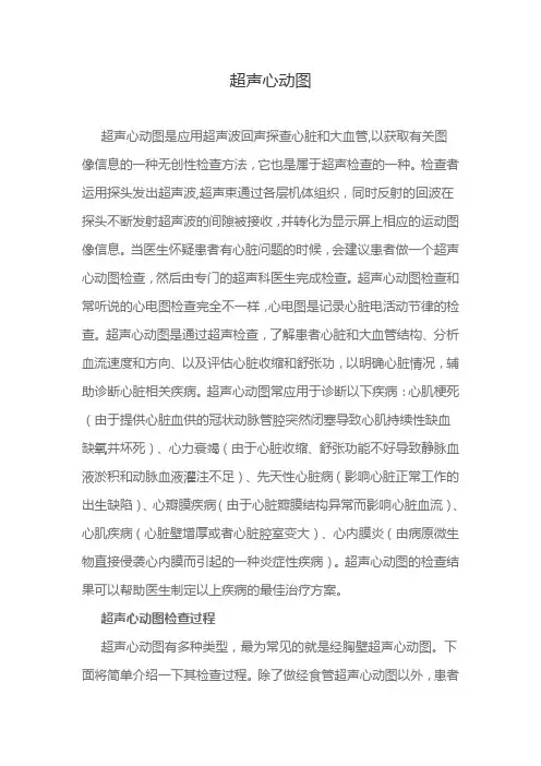超声心动图