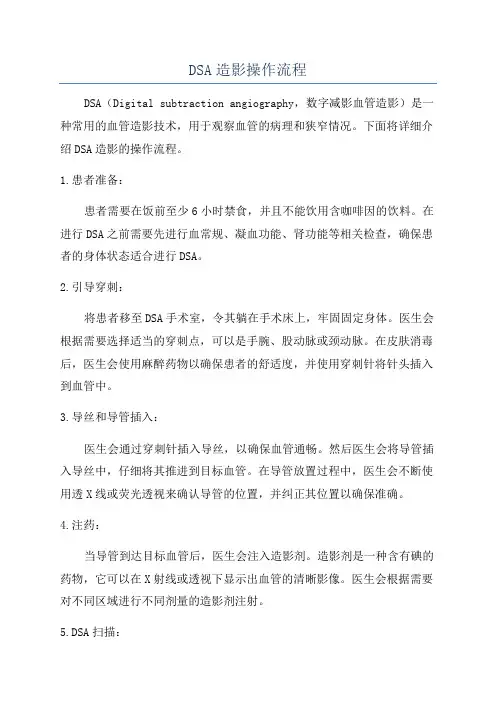 DSA造影操作流程