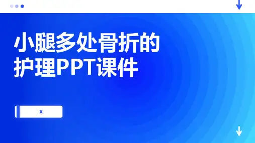 小腿多处骨折的护理PPT课件