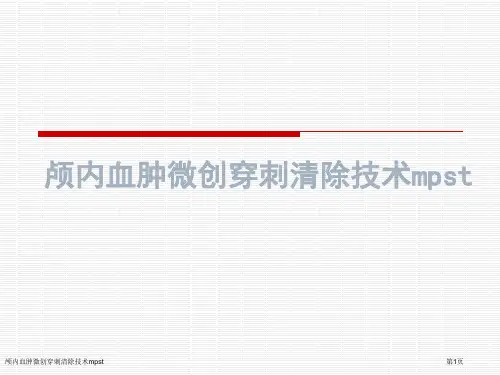 颅内血肿微创穿刺清除技术mpst