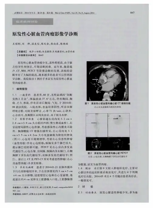 原发性心脏血管肉瘤影像学诊断