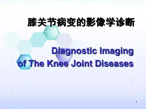 膝关节病变的影像学诊断PPT课件