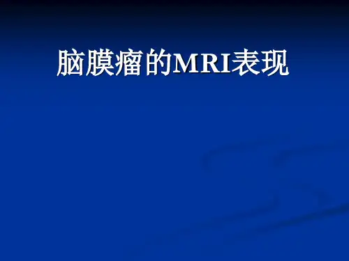 脑膜瘤MRI诊断