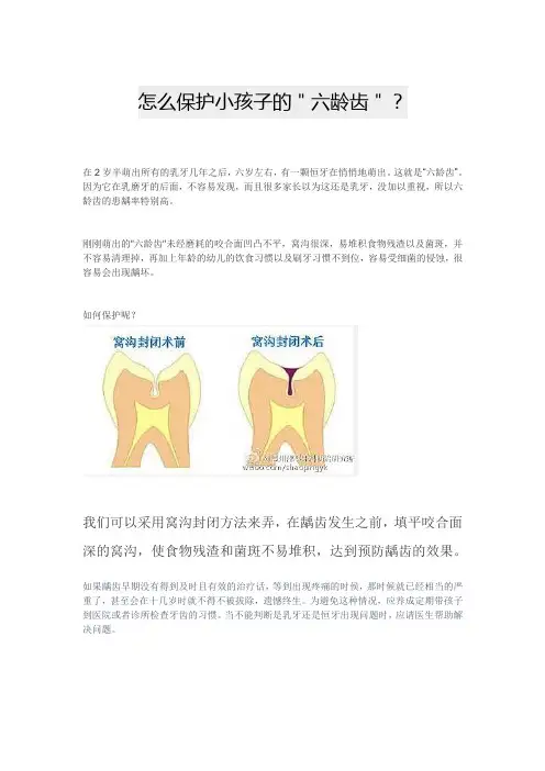 怎么保护小孩子的＂六龄齿＂？