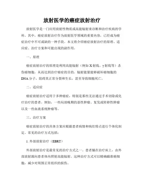 放射医学的癌症放射治疗