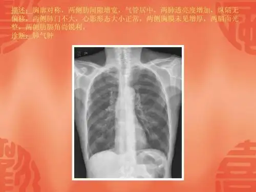 常见40张X片读片及诊断