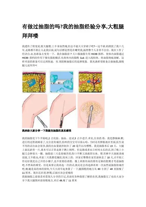 有做过抽脂的吗我的抽脂经验分享,大粗腿拜拜喽
