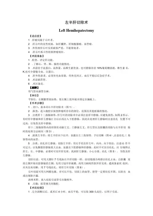 手术图谱资料：左半肝切除术