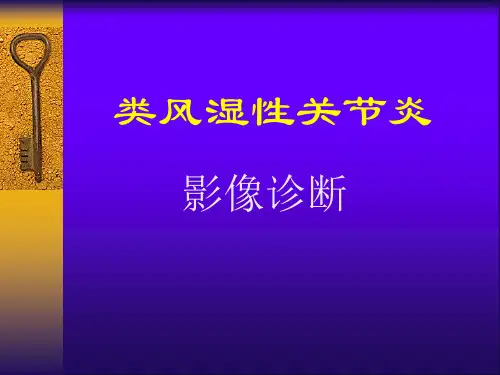类风湿性关节炎影像诊断