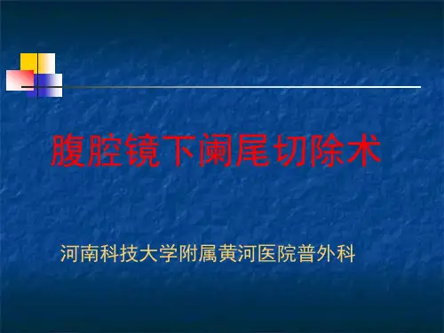腹腔镜阑尾切除术.