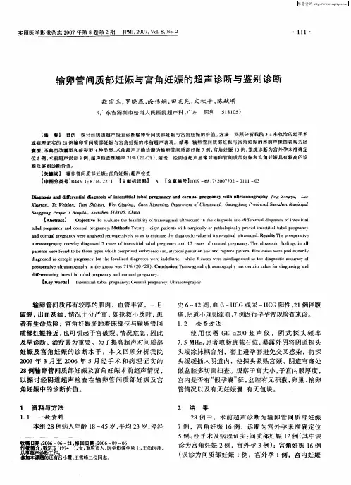 输卵管间质部妊娠与宫角妊娠的超声诊断与鉴别诊断