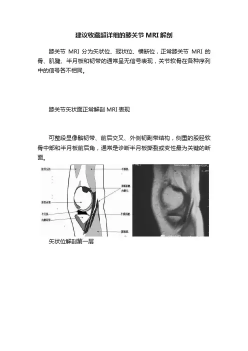 建议收藏超详细的膝关节MRI解剖