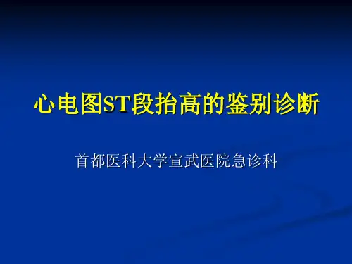 心电图ST段抬高的鉴别诊断
