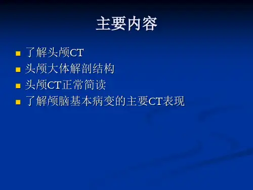 头颅CT简读-课件(2)
