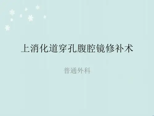 上消化道穿孔腹腔镜修补术  ppt课件