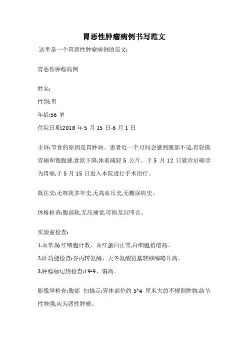 胃恶性肿瘤病例书写范文