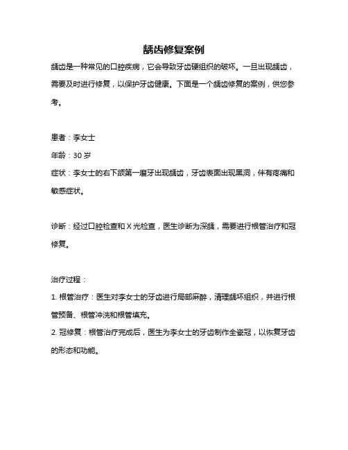龋齿修复案例