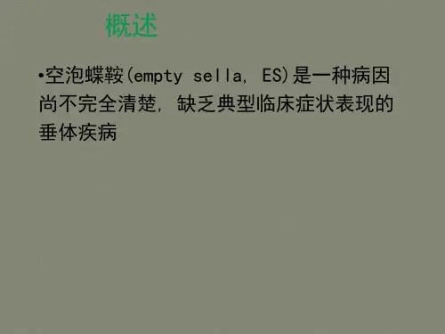 空泡蝶鞍的MRI表现