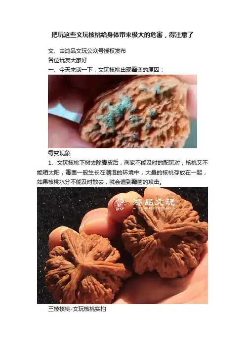 把玩这些文玩核桃给身体带来极大的危害，得注意了