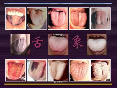 中医学-舌诊-医学精品课件