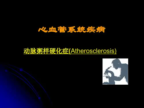 动脉粥样硬化症 PPT课件