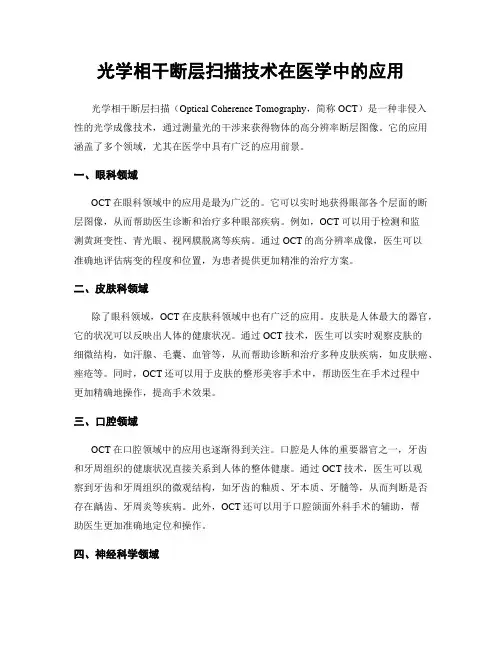 光学相干断层扫描技术在医学中的应用