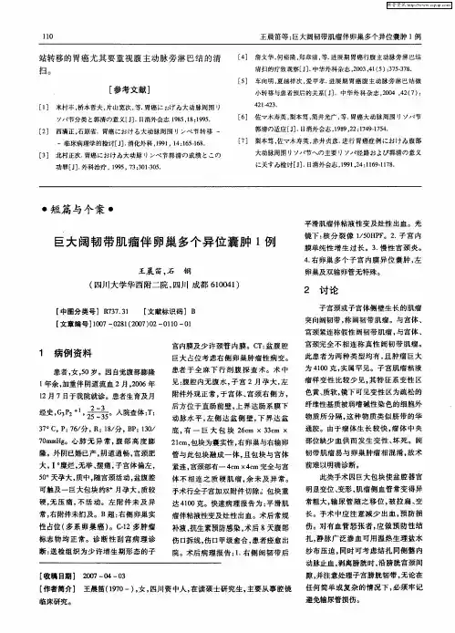 巨大阔韧带肌瘤伴卵巢多个异位囊肿1例