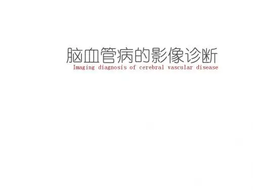 脑血管病的影像诊断  ppt课件