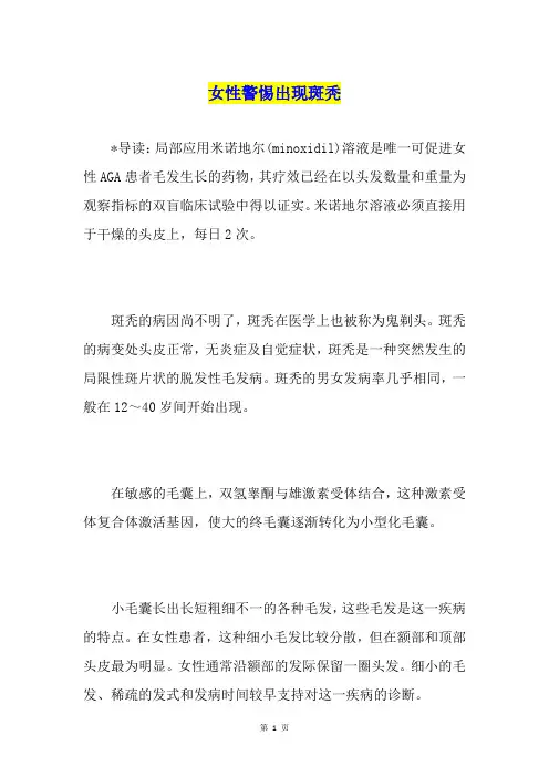 女性警惕出现斑秃
