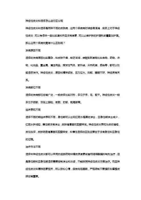 神经性皮炎和湿疹怎么进行区分呢