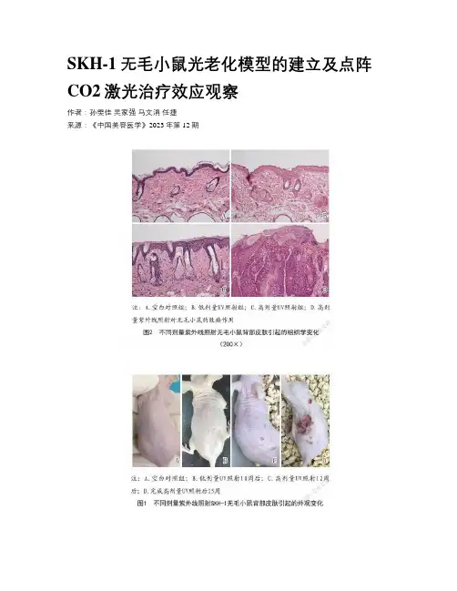 SKH-1无毛小鼠光老化模型的建立及点阵CO2激光治疗效应观察