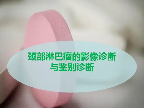 颈部淋巴瘤的影像诊断与鉴别诊断