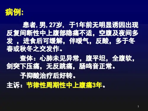 消化性溃疡病例讨论PPT课件