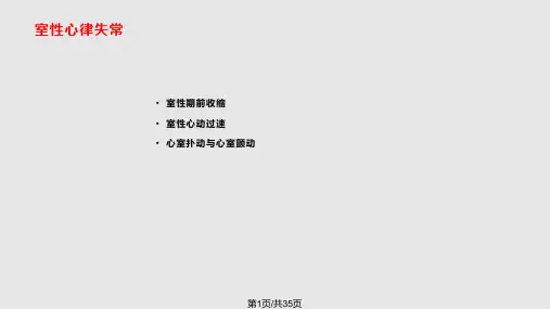 室性心律失常第PPT课件