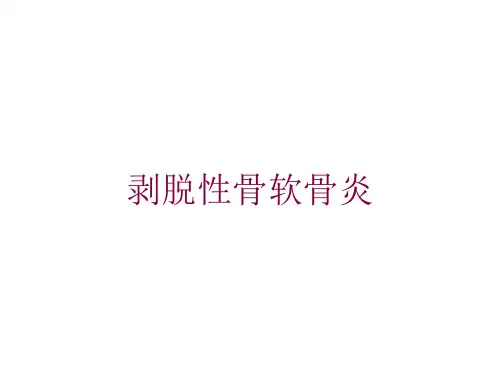 剥脱性骨软骨炎培训课件