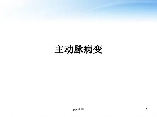 主动脉病变  ppt课件