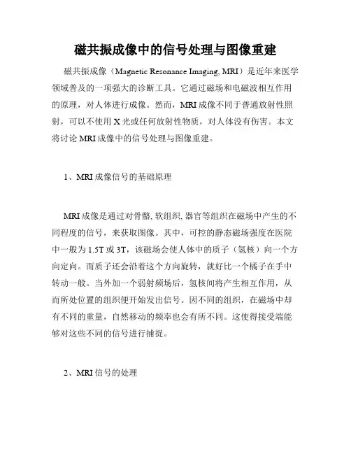 磁共振成像中的信号处理与图像重建