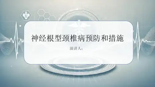 神经根型颈椎病预防和措施