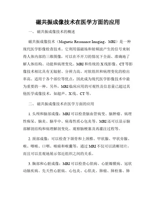 磁共振成像技术在医学方面的应用