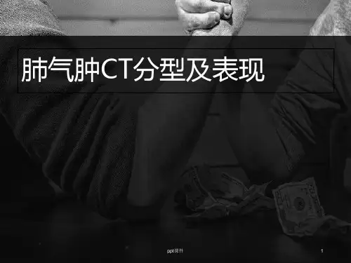 肺气肿分型  ppt课件