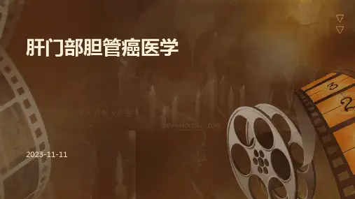 肝门部胆管癌医学