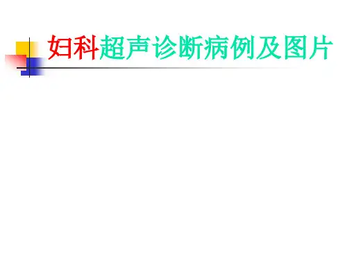 妇科超声诊断病例及图ppt课件