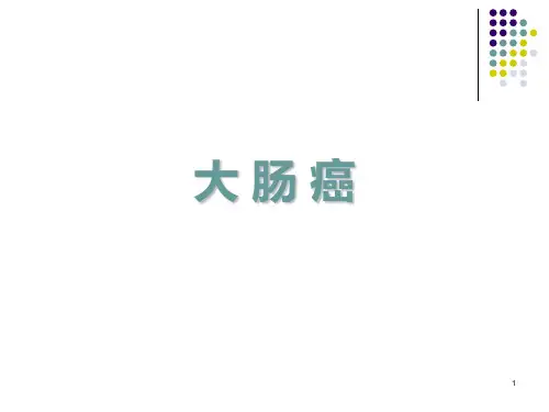 结肠癌ppt课件