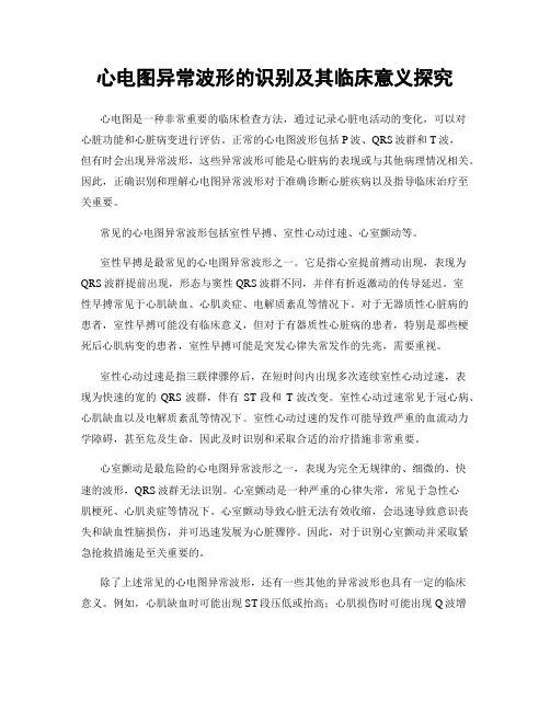 心电图异常波形的识别及其临床意义探究