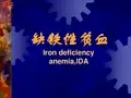 《缺铁性贫血》PPT课件