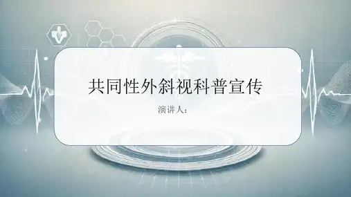 共同性外斜视科普宣传PPT