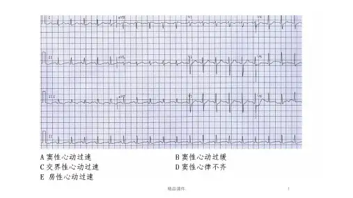 心电图练习题(带图有答案)教案.ppt